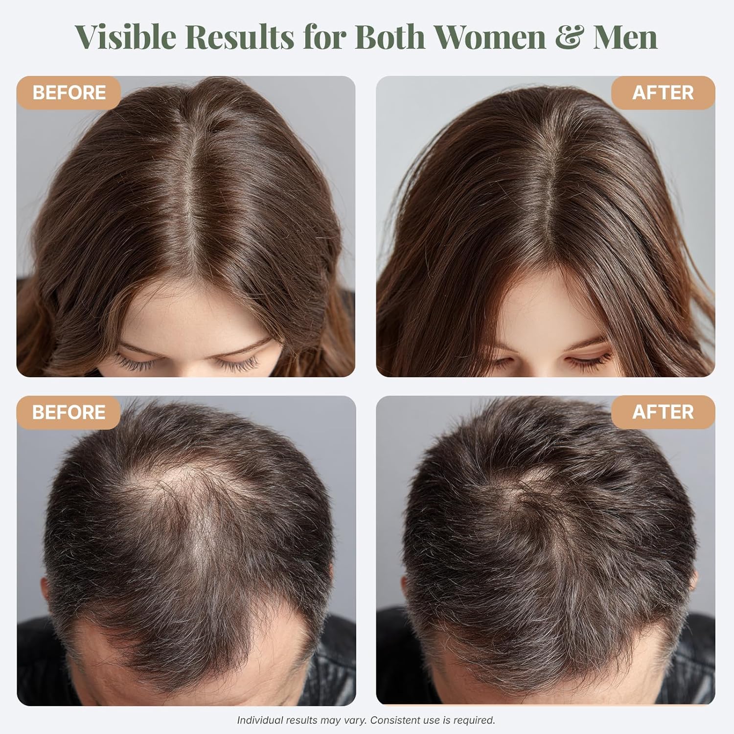 Transform Your Hair with ÉLIX USDA Organic Rosemary Oil - Nourishing Thickening Formula for Hair Growth with Castor & Pumpkin Seed - Perfect for Thinning Hair, Made in the USA - 4Oz
