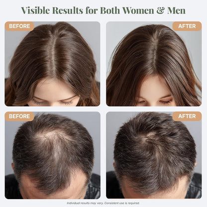 Transform Your Hair with ÉLIX USDA Organic Rosemary Oil - Nourishing Thickening Formula for Hair Growth with Castor & Pumpkin Seed - Perfect for Thinning Hair, Made in the USA - 4Oz